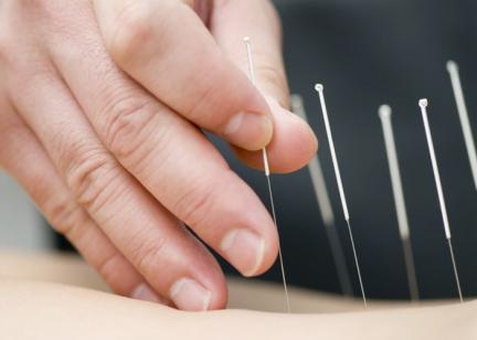 Acupuncture Asheville